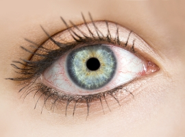  Покраснение глаз: почему возникает и как от него избавиться