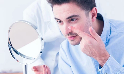 Как купить линзы в первый раз